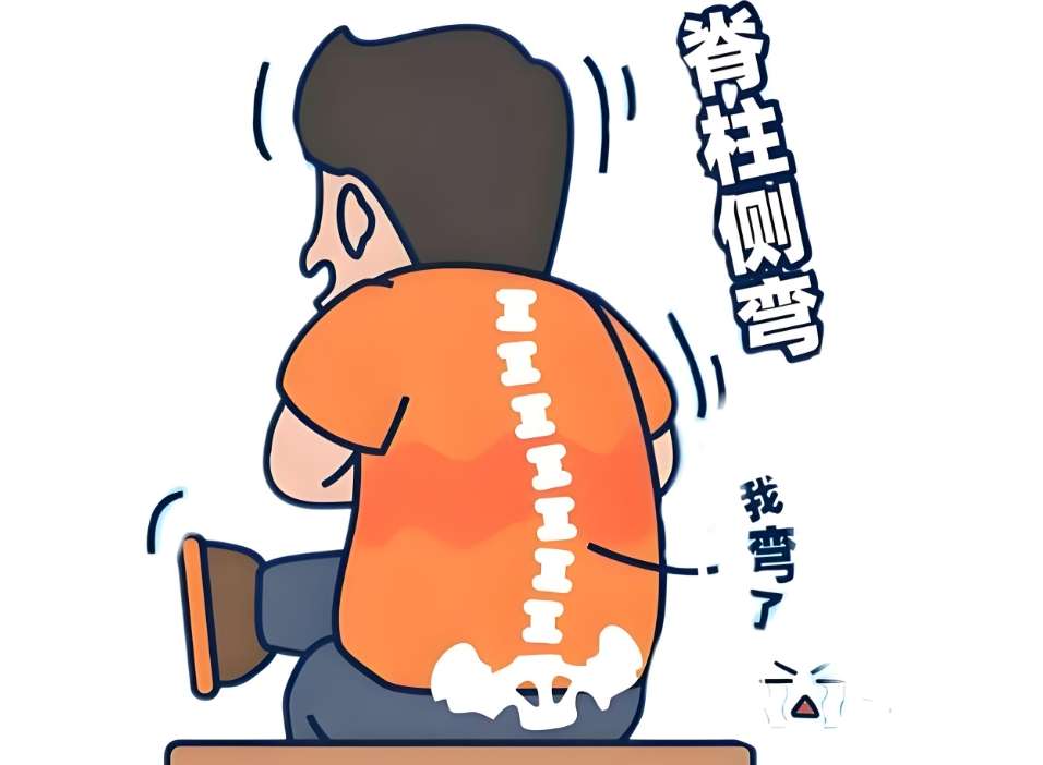 脊椎 側 彎 不能 做 什麼 運動