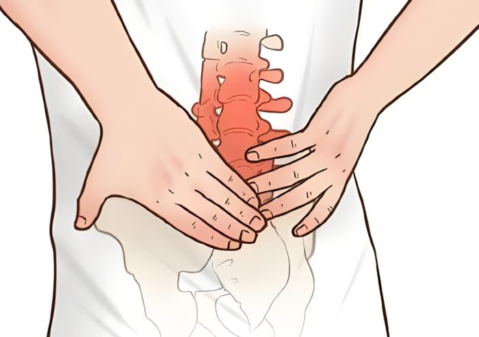 僵直性脊椎炎症狀 僵直性脊椎炎症狀