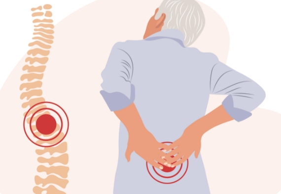 椎間盤鈣化治療 椎間盤鈣化治療